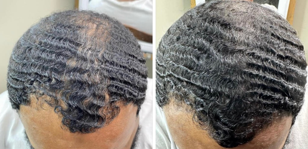 eXplosive GROWTH Oil – Advanced Hair & Scalp Nourishment for Accelerated Growth